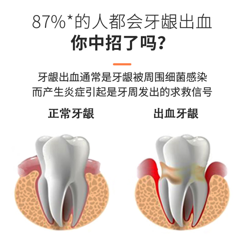 舒客(Saky) 专效护龈维他命牙膏香橙薄荷120g高清大图