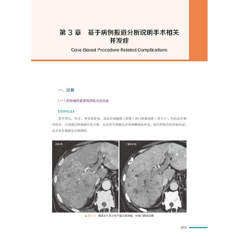 正版新书]非血管介入治疗与肿瘤介入并发症:基于病例的解决方案高清大图