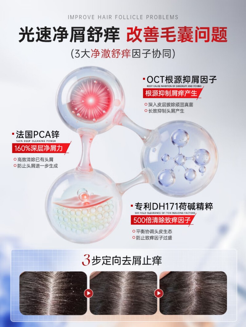 儒意RUYI二硫化硒去屑控油洗发水800g高清大图
