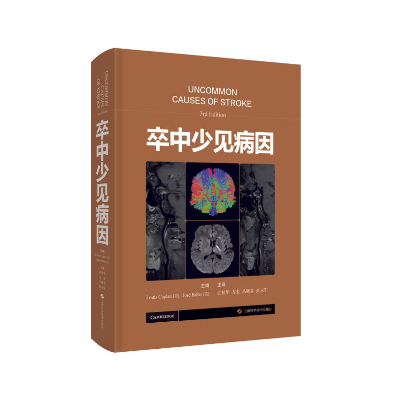 醉染图书卒中少见病因(精)9787547856437