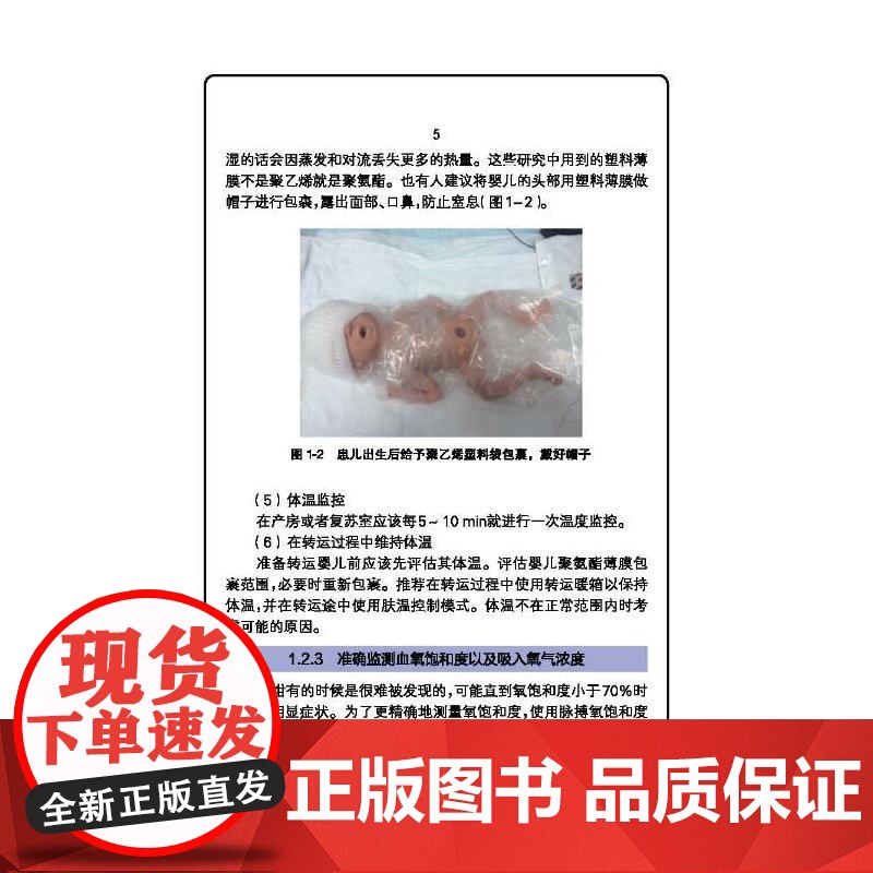 极超低出生体重儿精细化护理高清大图
