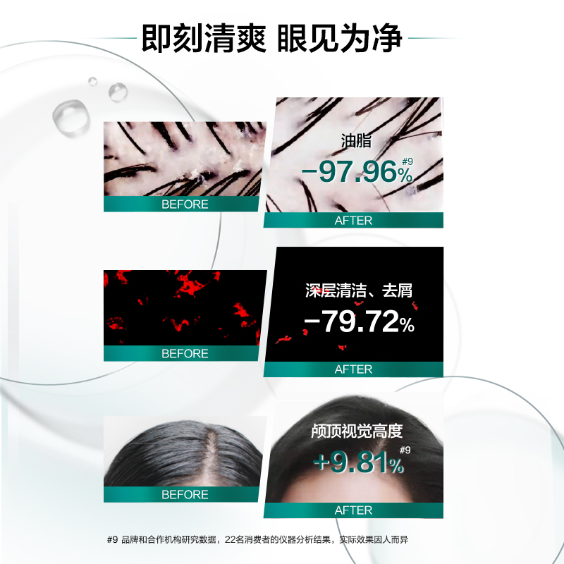 [赠品]欧莱雅(LOREAL)头皮控油净化洗发露100ml(洗发水小样 有非卖品字样)