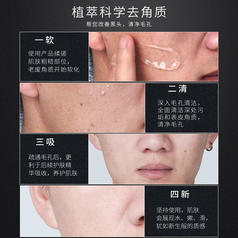 劲爽控油去角质啫喱200ml 去角质男女面部黑头深层清洁收缩毛孔皮全身身体脸部洁面慕斯