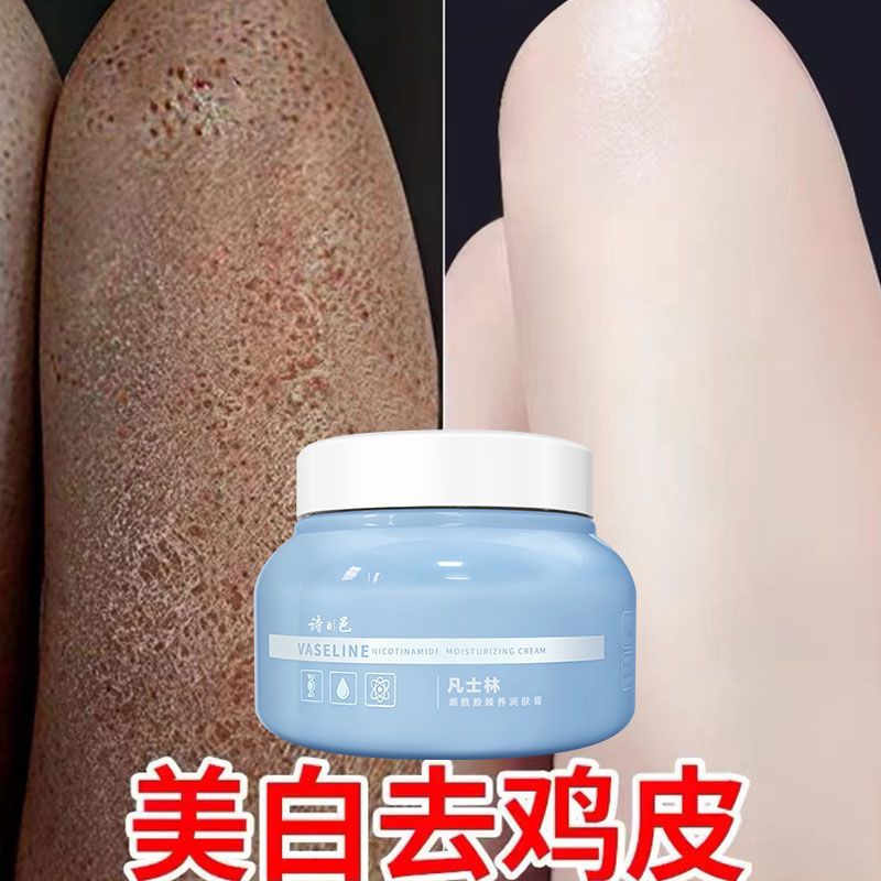 [一抹嫩]身体乳保湿补水皮肤干燥滋润持久美白香体乳去鸡皮男女 凡士林身体乳[3天美白去鸡皮] 1盒250g[滋润保湿肌肤