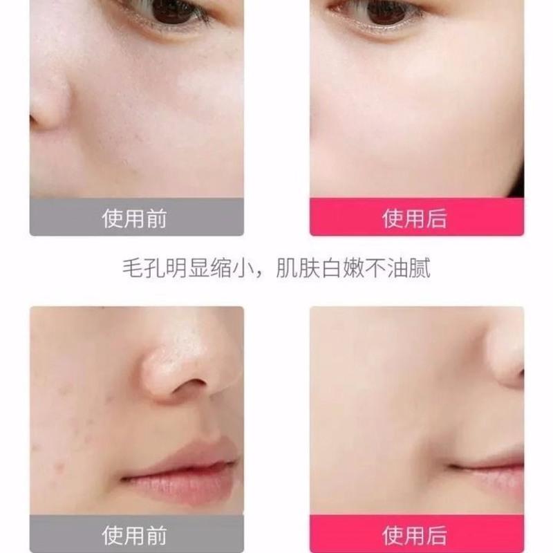 纳米喷雾补水仪蒸脸器加大雾排毒美白家用补水仪喷雾器补水新升级 尊贵白色 热喷蒸脸器(无赠品)