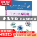 生活中的罕见病