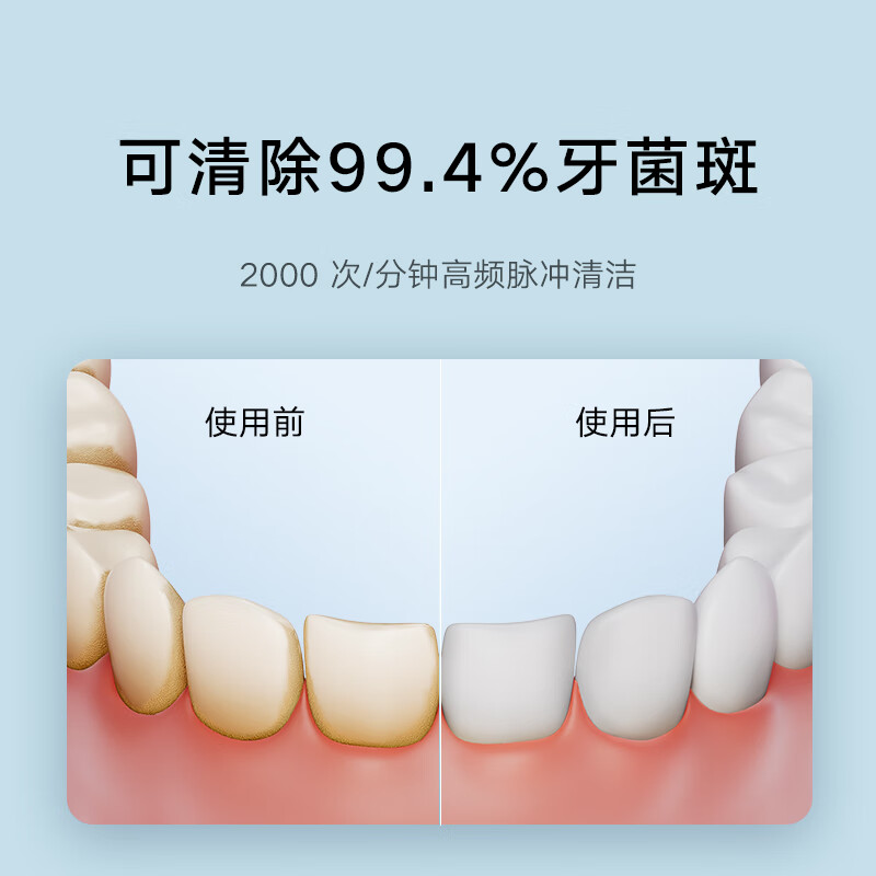 小米米家电动冲牙器F300 白色 家用便携水牙线口腔洁洗牙器高清大图