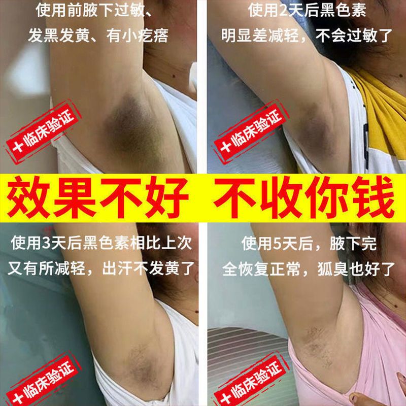[油耳性狐臭]胳肢窝去狐臭永久狐臭净腋下除臭除汗臭止汗喷雾 即刻见效[一瓶装]白云山除臭液