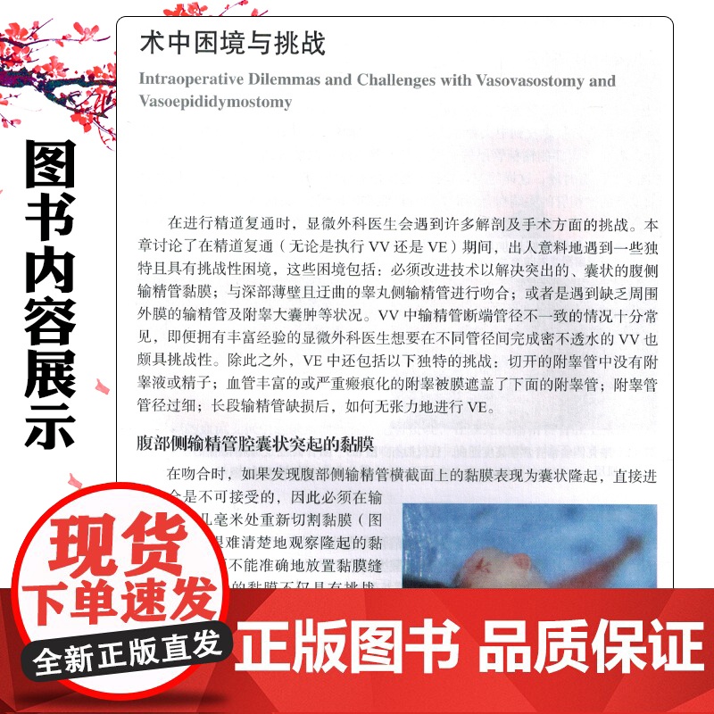 精道复通:输精管吻合术与输精管附睾吻合术实用手册 上海科学技术出版社9787547869598高清大图
