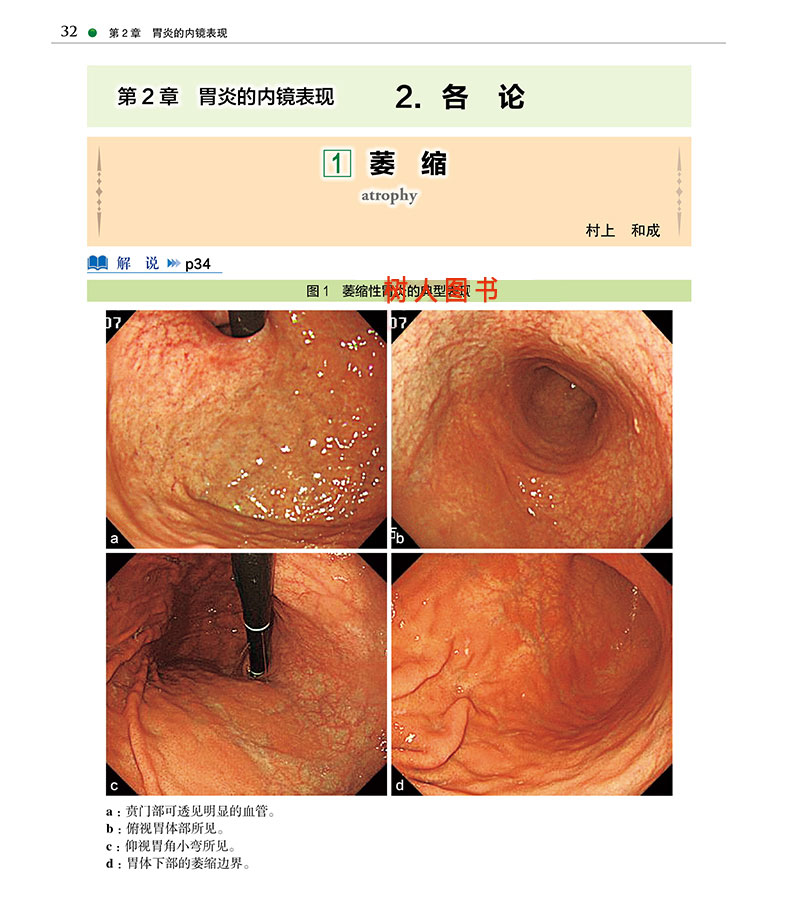 [正版] 京都胃炎分类 临床医学类书籍 胃炎分类辅助诊断治疗参考书籍 胃炎内镜诊断治疗技术书籍 慢性胃炎胃癌风险内镜诊断高清大图