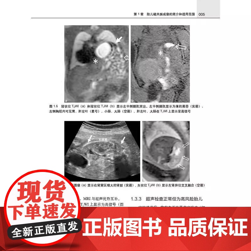 胎儿磁共振成像 中文翻译版 王荣品 钟玉敏主译 适用各级影像科医生及妇产科科医生 胎儿磁共振诊断初学者学习 科学出版社高清大图