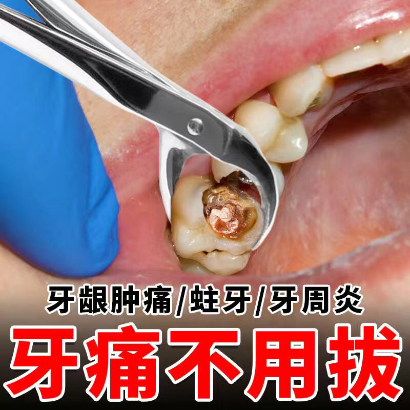 快速治蛀牙蚜虫牙洞虫牙智齿发炎消炎杀菌止痛牙痛抑菌治牙根肿痛