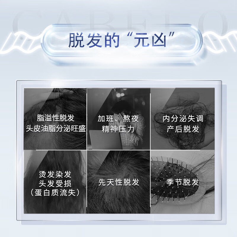 卡蓓诺育发洗头水(基础型)350mL 洗发水高清大图