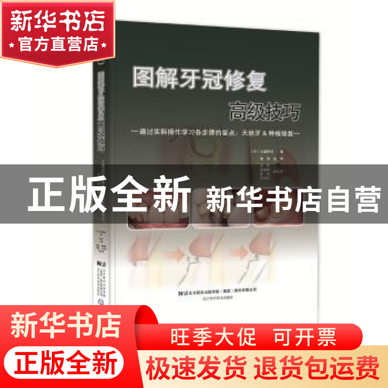 正版 图解牙冠修复高级技巧 (日)土屋贤司著 辽宁科学技术出版社