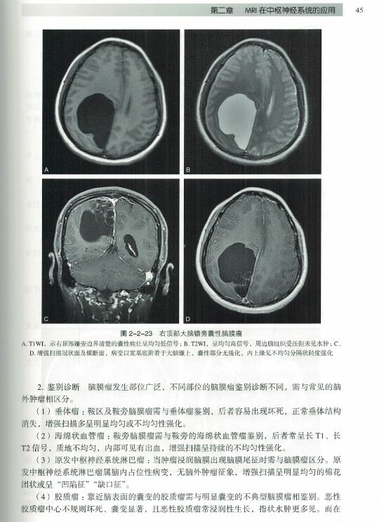[正版] MRI读片指南 临床影像诊断丛书 夏黎明 邵剑波 孙子燕主编 可搭CT读片指南 北京大学医学出版社97875高清大图