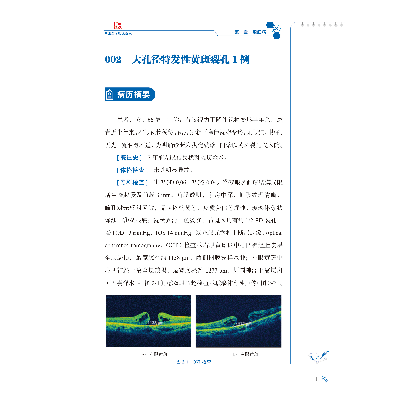 醉染图书南昌大学第二附属医院眼科病例精解9787518965403高清大图
