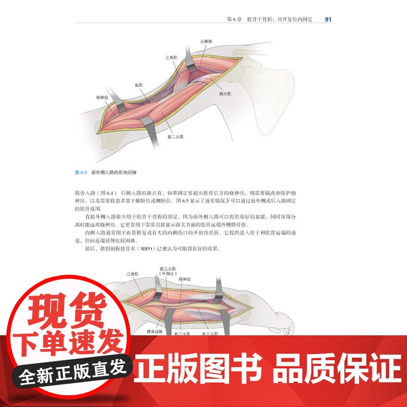 [出版社]骨科标准手术技术丛书 骨折 第四4版 临床指南 医学专业 骨科医生工具书 医学生骨科 辽宁科学技术出版社高清大图