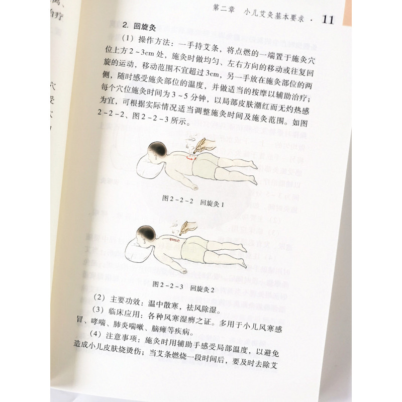 [醉染正版]小儿艾灸 刘明军 陈邵涛 常见病调理 治疗方法 小儿适宜技术丛书 中国中医药出版社 儿童艾灸 小儿健康 书籍