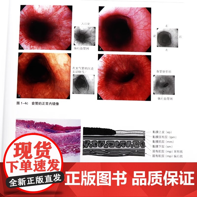 [央视网]内镜诊断与鉴别诊断图谱 上消化道第2版 胃镜书 上消化道内镜诊断秘籍 实用消化内科学 临床医学辽宁科学技术出版高清大图