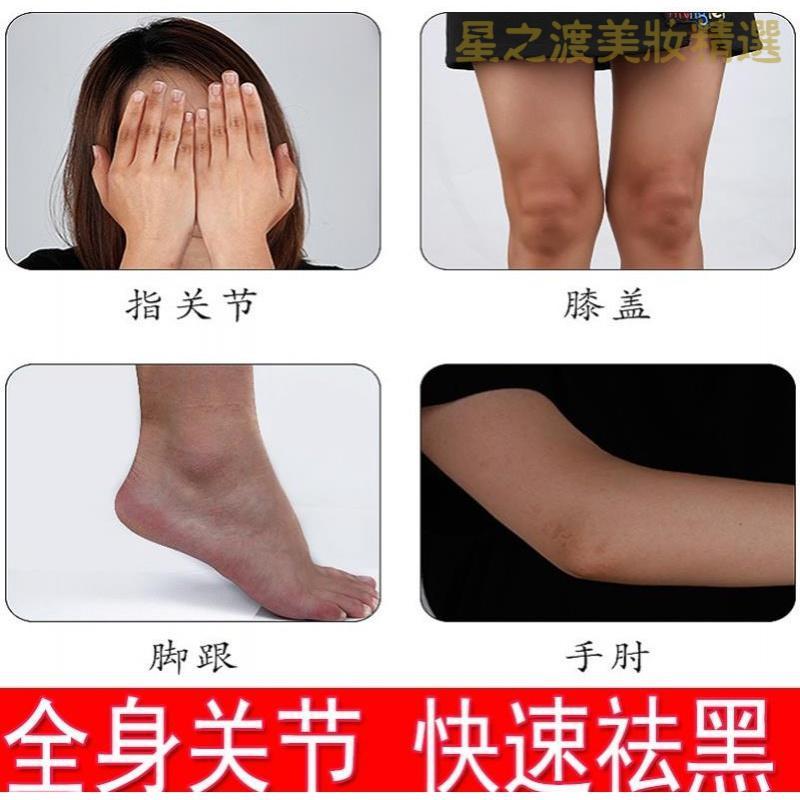樱色按摩膏 优选好货 关节腋下去黑去黑色素沉淀手肘膝盖全身屁股黑坐印去除按摩膏 价格图片品牌报价 苏宁易购星之渡美妆个护专营店