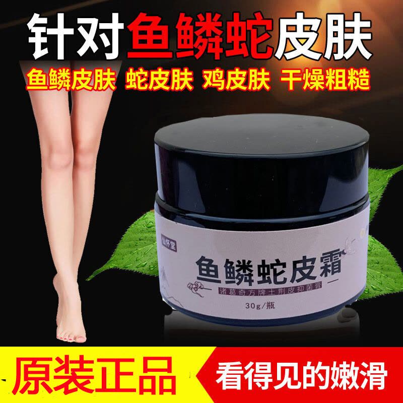 鸡皮肤去鱼鳞蛇皮肤干燥起皮脱皮全身体软膏乳膏买1送1图片