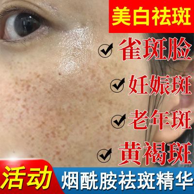 [烟酰胺美白祛斑精华液]黄褐斑雀斑去老年色斑去黄补水收缩毛孔 [烟酰胺美白祛斑精华液]100ml