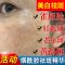[烟酰胺美白祛斑精华液]黄褐斑雀斑去老年色斑去黄补水收缩毛孔 [烟酰胺美白祛斑精华液]100ml