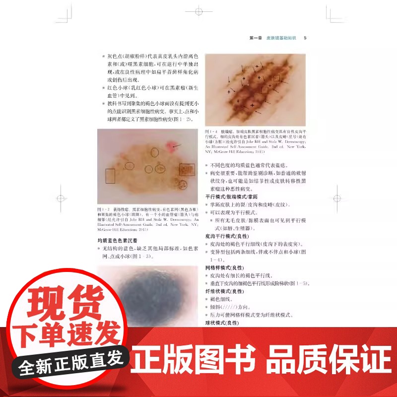 皮肤镜诊断精要与图解 涉及病例数多达105例 图片为主 细致的分析 皮肤科医学书 皮肤镜诊断图谱 皮肤镜标准综述 皮肤病高清大图
