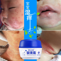 紫草膏宝宝湿疹膏戒馆之婴亲霜 婴儿口水疹尿布疹热痱子湿疹皮炎红屁屁护臀膏 奶廯润肤面霜淹红脖子肤乐霜皮肤止痒膏消肿膏面霜