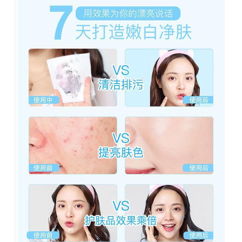 [清洁毛孔]紫苏净透竹炭清洁啫喱膏毛孔清洁去黑头粉刺排毒美白 [清洁毛孔]紫苏净透竹炭清洁啫喱膏毛孔清洁去黑头粉刺排毒美