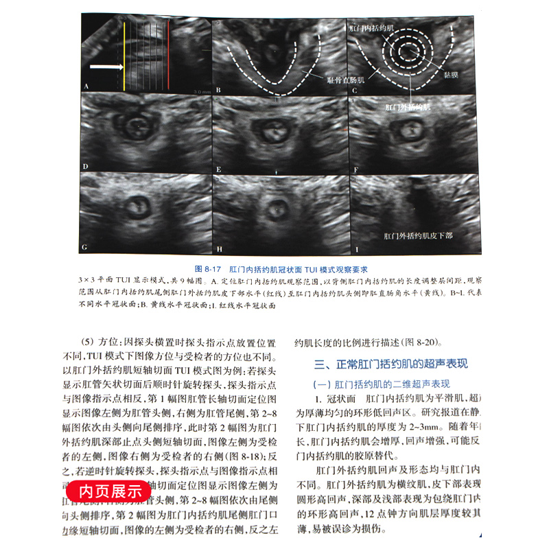 [正版] 实用盆底超声诊断学 张新玲主编 妇产科学 医学妇产科学 实用超声诊断影像学 盆底超声检查盆底肌肉损伤97高清大图