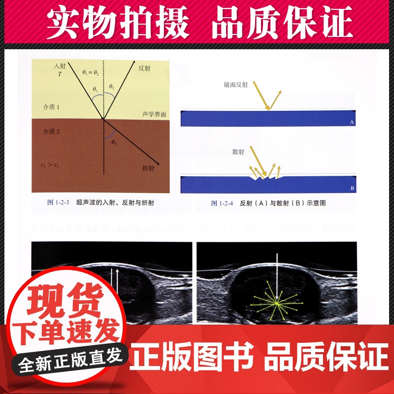 皮肤超声诊断学 皮肤疾病超声诊断扫查 皮肤临床医师超声工具书 皮肤疾病超声诊断 徐辉雄主编 上海科学技术出版社高清大图