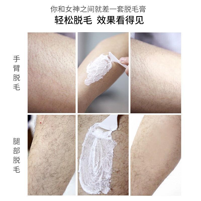 托毛膏全身去汗毛托毛膏高神器男女士学生抑毛拖毛膏全身腿部去腿毛 100g