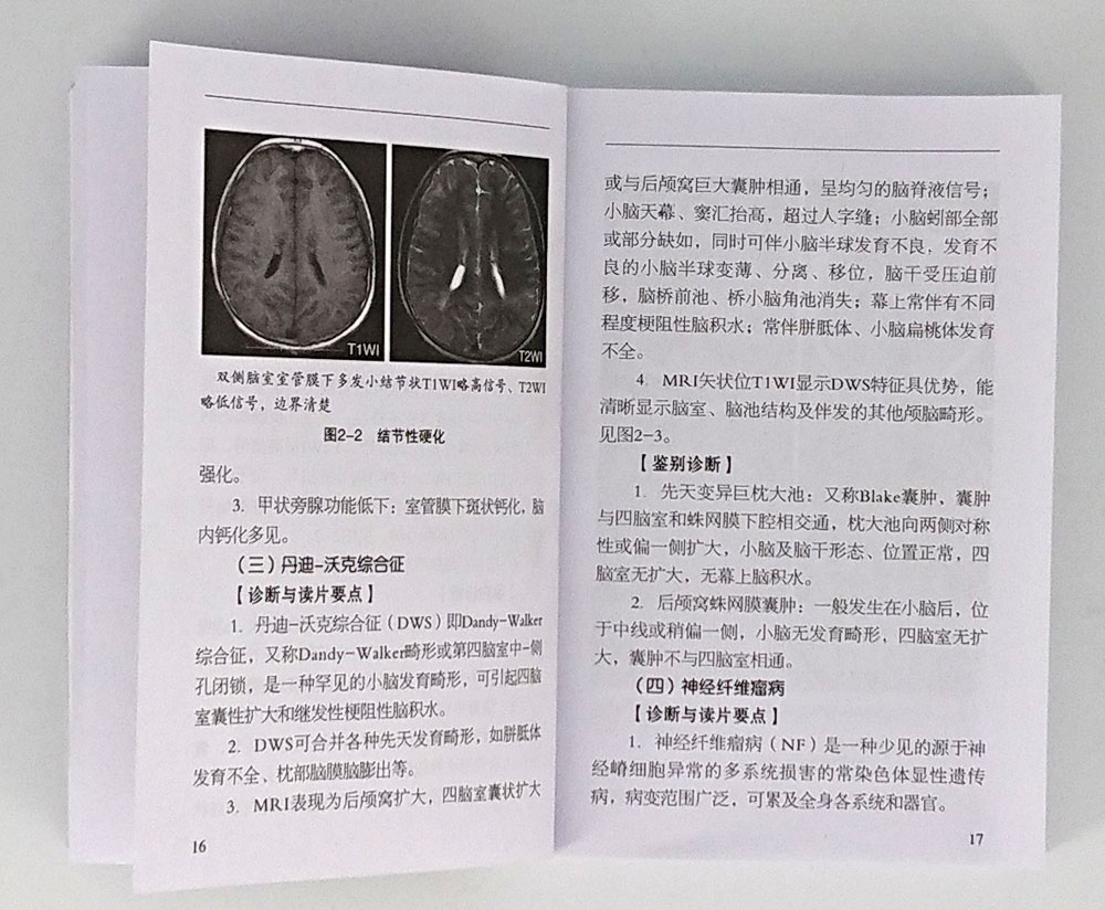 [醉染正版]临床实用MRI掌中宝 科学、简明、实用的临床宝典 正版 书籍 医学 口袋书读片指南mri手册医学影像诊断系高清大图