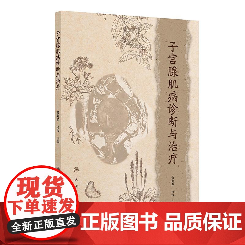 子宫腺肌病诊断与治疗高清大图