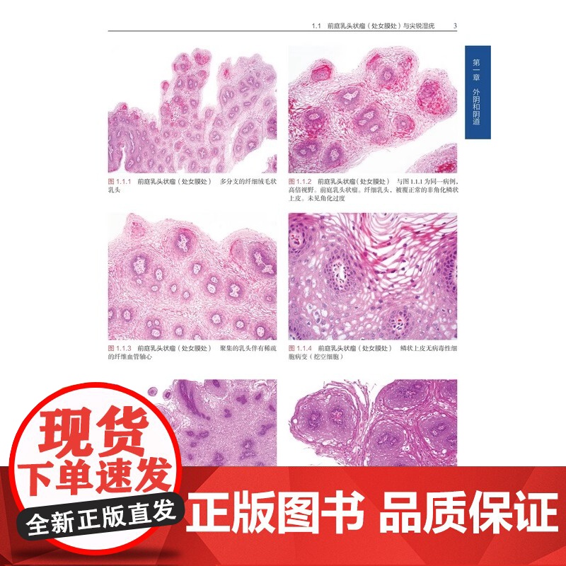[央视网]外科病理鉴别诊断图谱 女性生殖道 172个鉴别诊断表格和1596幅高清典型病理图片相结合 医学外科学书籍 BJ高清大图