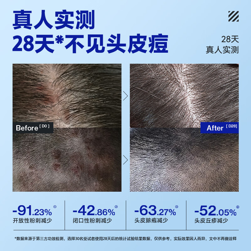 海洋至尊 净痘洗发沐浴400ml*2+三棱镜洁面150g高清大图