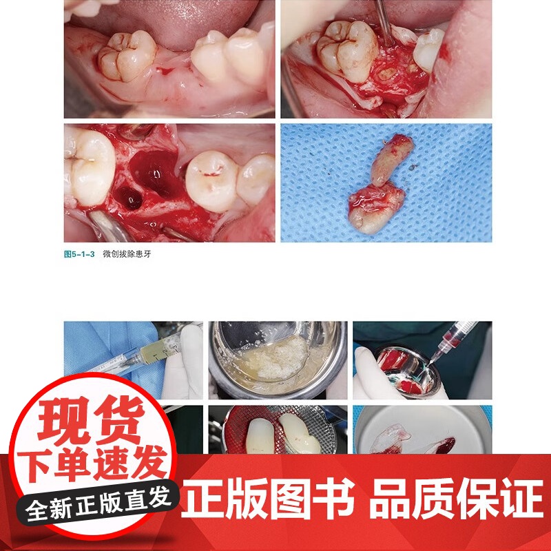 [出版社]黏性骨块临床基础及应用 撒悦 李军 口腔科学书籍 黏性骨块临床应用病例解析 辽宁科学技术出版社 骨缺损重建黏性高清大图