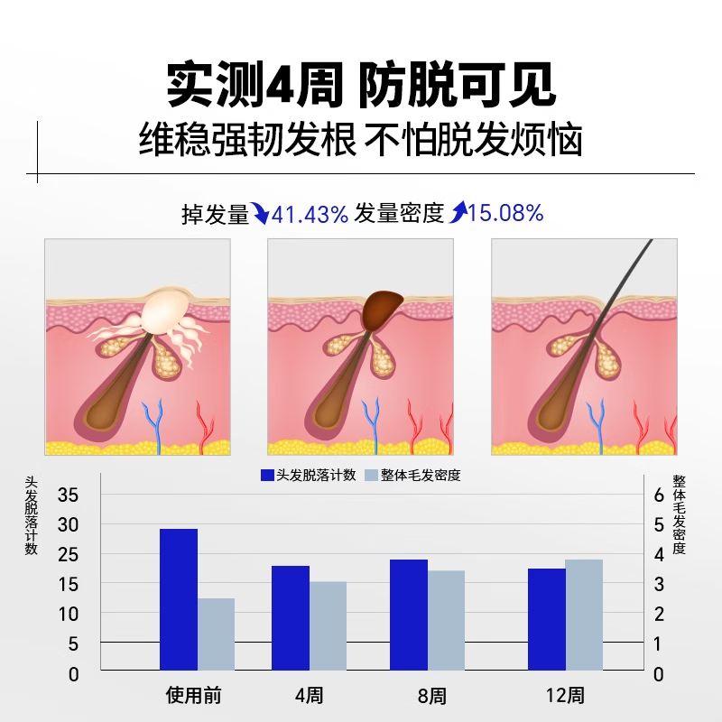 EHD防脱防断固发洗发水500ml高清大图