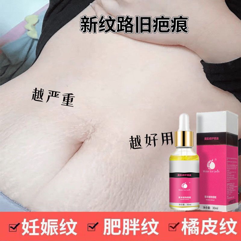 去妊娠纹产后修复霜紧致肚皮产前孕妇用品肥胖纹孕期预防专用 肌肤修护霜