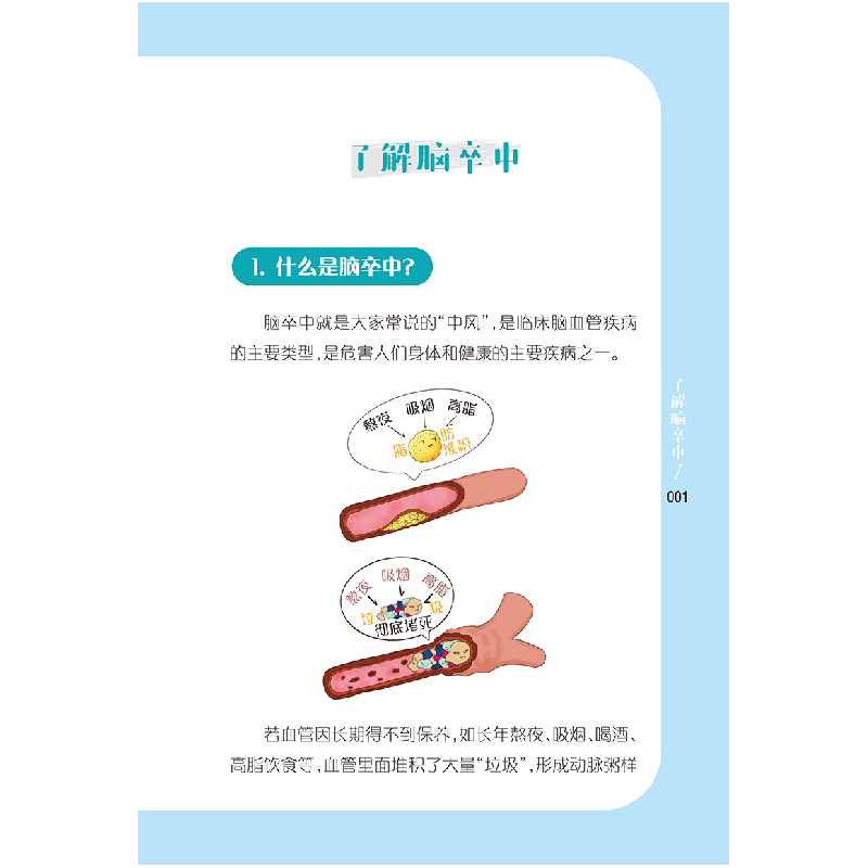 正版新书]漫画脑卒中居家照护朱小玉9787312060175高清大图
