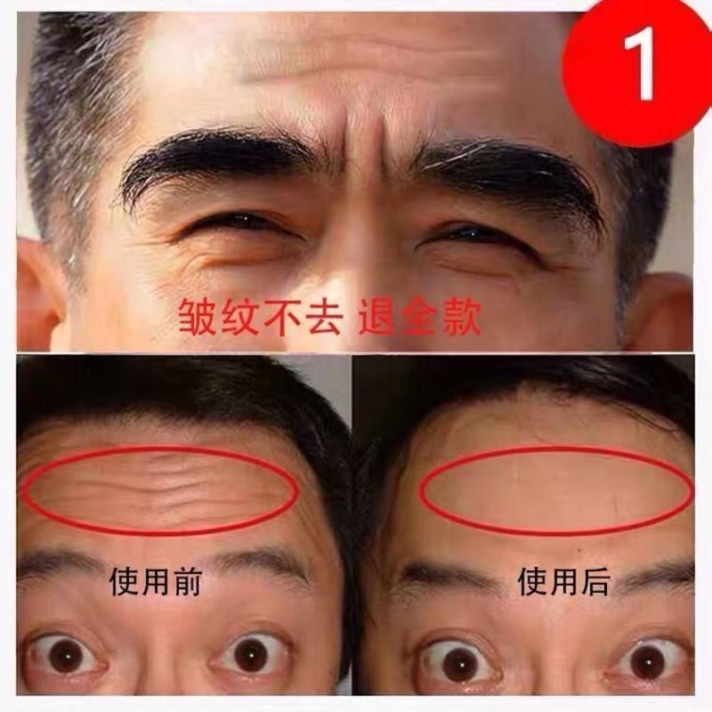 南京同仁堂绿金家园男士专用抗皱紧致去皱纹抬头纹面霜保湿护肤品 刚发现者使用-轻度皱纹*1 [全新升级]南京同仁堂绿金家园