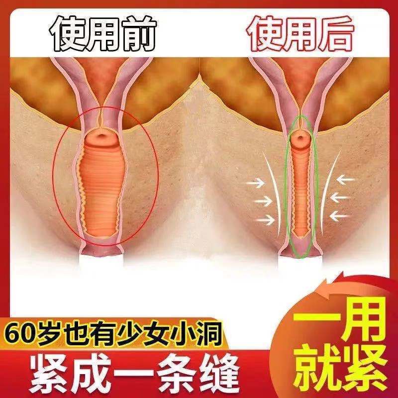 一盒缩紧体验 缩阴紧润去异味妇科清宫私处粉嫩凝胶阴吹排毒杀菌痒白带高潮松弛