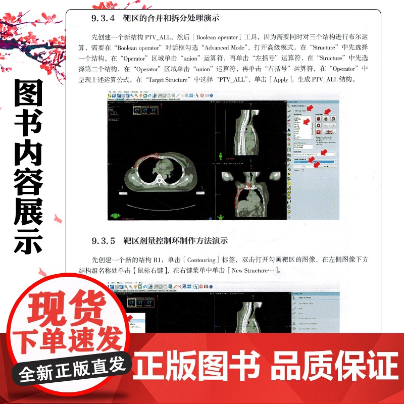 调强放疗计划设计基础知识与系统质控 北京大学医学出版社9787565932236高清大图