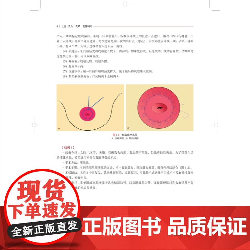 私密整形外科手术图解 外生殖器畸形美容外科乳腺外科上海科学技术出版社临床医学外科学高清大图