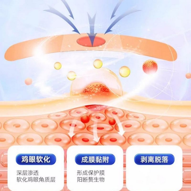 海氏海诺 6贴装医用足部创面护理贴脚部老茧瘊子鸡眼清除创面护理贴辅助理疗鸡眼贴高清大图