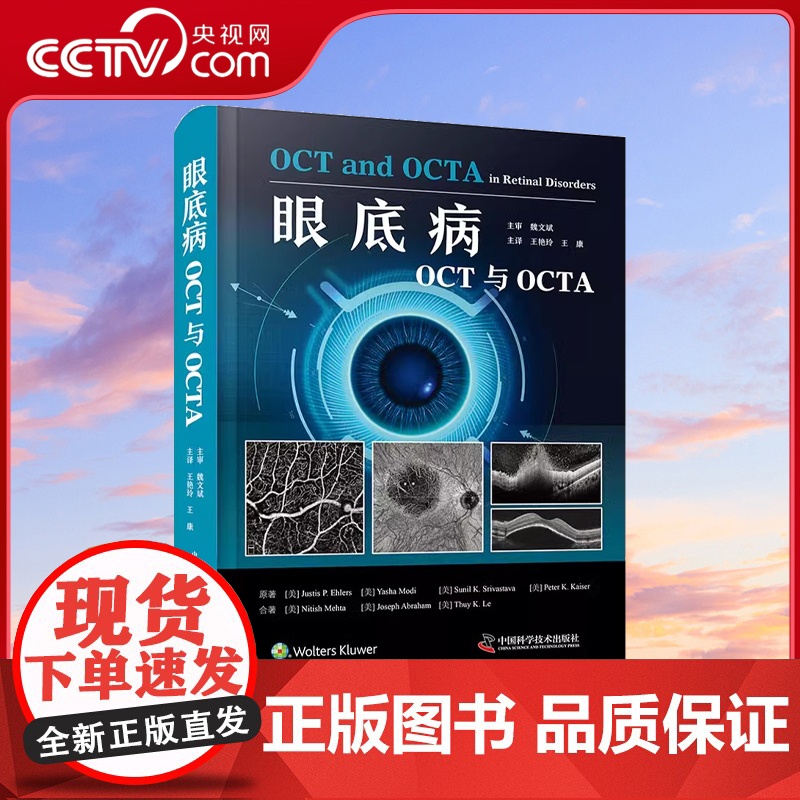 【央视网】眼底病OCT与OCTA 以言简意赅的表达形式对不同眼底疾病的影像特征进行细致描述 并配有丰富的图片资料ZK