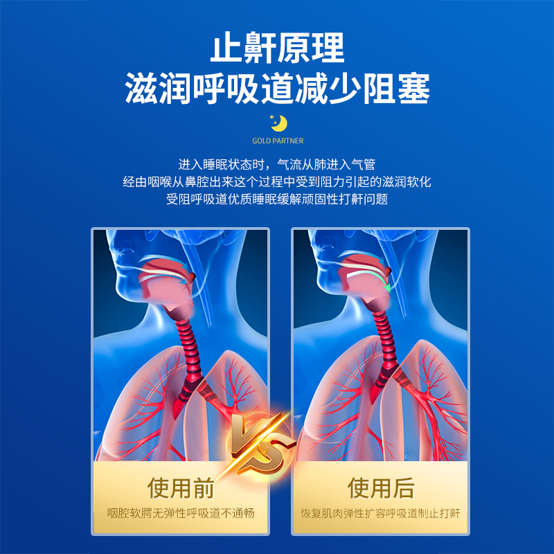 修正止鼾器防打呼噜专用消打鼾液体治阻喷剂睡觉疗男士神器915