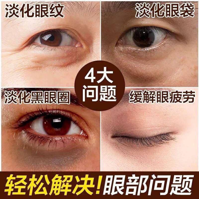 眼霜40g [上市]鱼子酱冻龄修护眼霜眼袋黑眼圈抚平眼纹且保湿熬夜精华