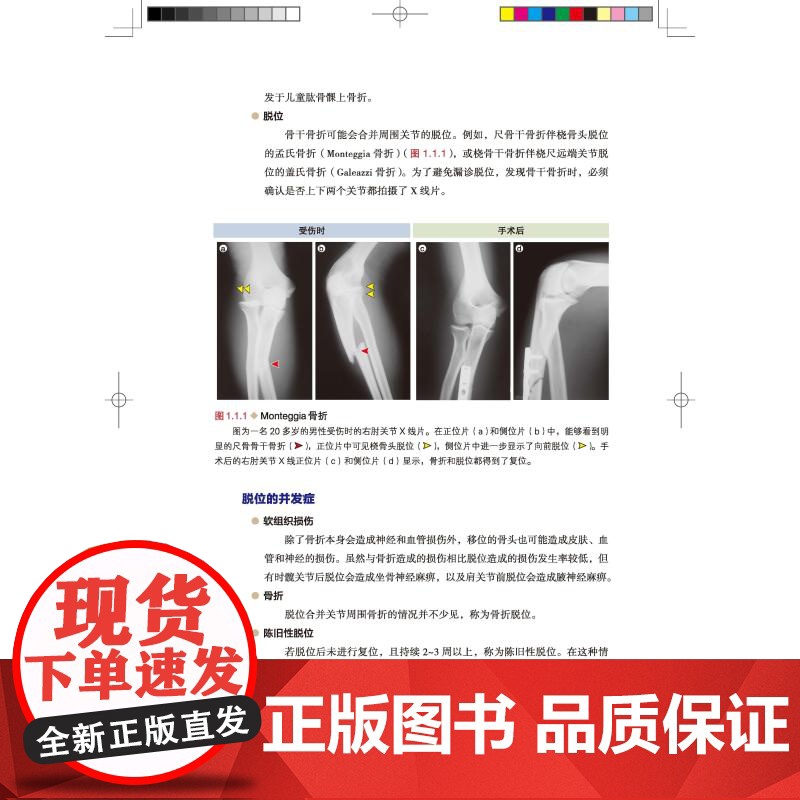 骨折 脱位 损伤:影像诊断及治疗图解 详细分型 高清图片 视频演示 北京科学技术高清大图